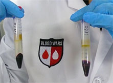 Two vials of blood
